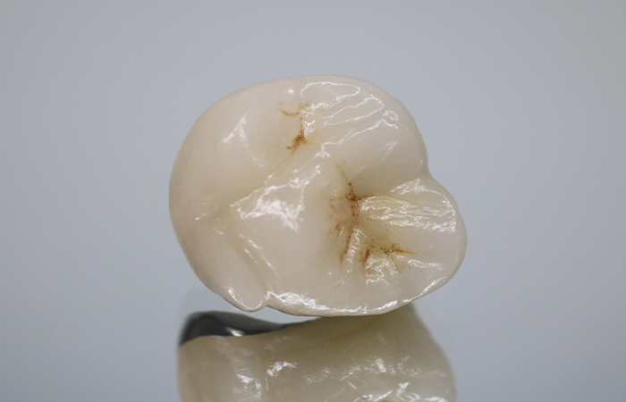 ジルコニアクラウン