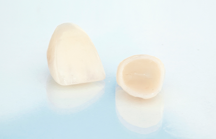 ハイブリッドセラミック