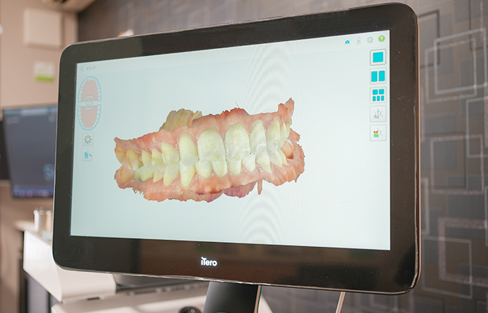 精度の高いマウスピースを作るために…