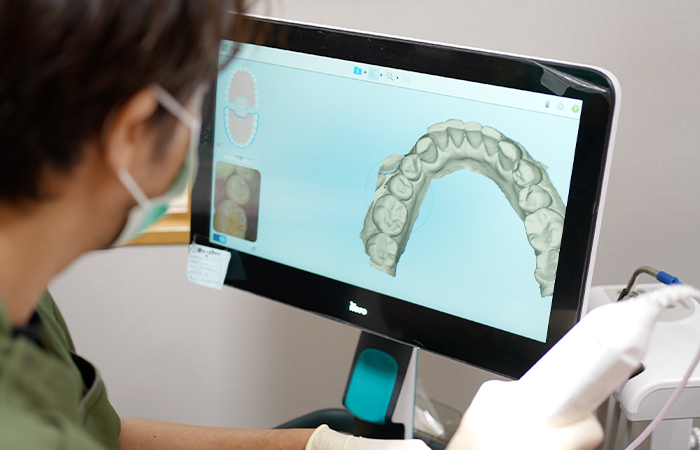 精密検査と口腔内スキャン