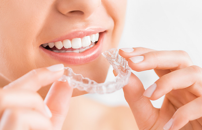 矯正治療の開始